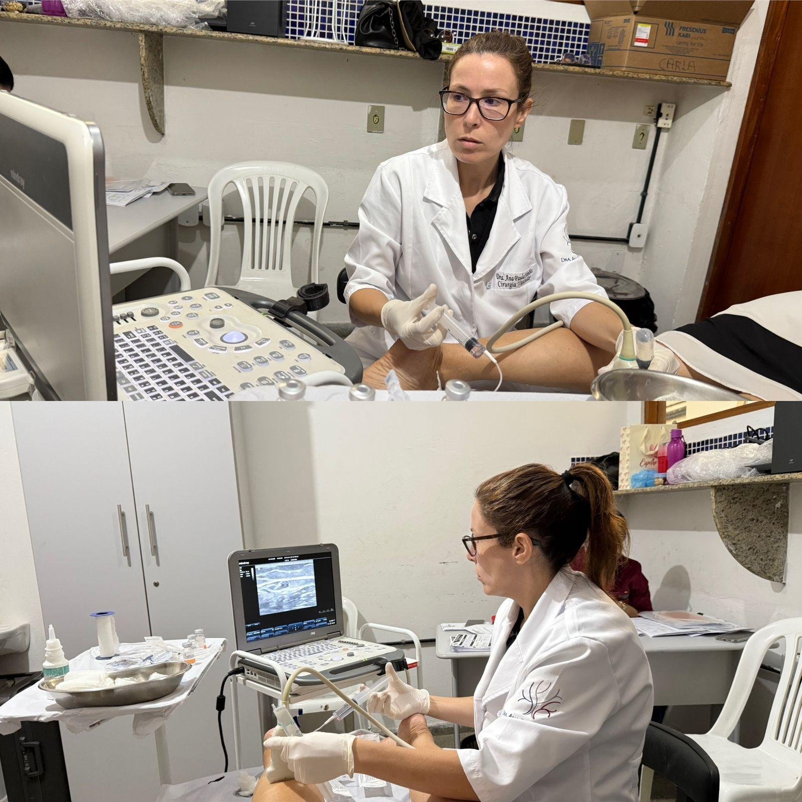 POLICLÍNICA MUNICIPAL DE ILHÉUS INICIA TRATAMENTO DE VARIZES COM ESPUMA GUIADA POR ULTRASSOM 