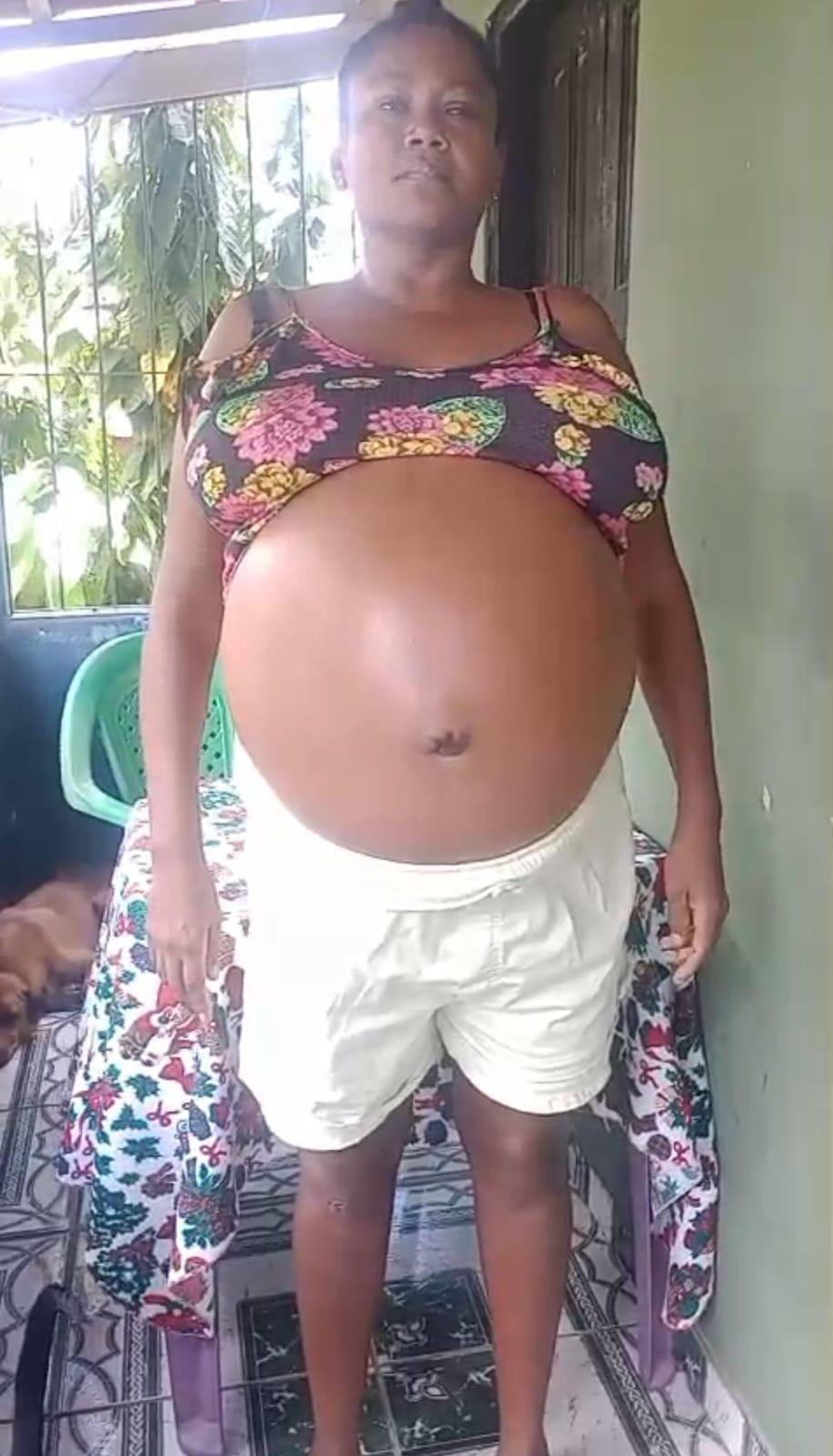 PESCADORA DE LAGOA ENCANTADA PEDE AJUDA PARA REALIZAR CIRURGIA ESTIMADA EM R$ 10 MIL PESCADORA DE LAGOA ENCANTADA PEDE AJUDA PARA REALIZAR CIRURGIA ESTIMADA EM R$ 10 MIL
