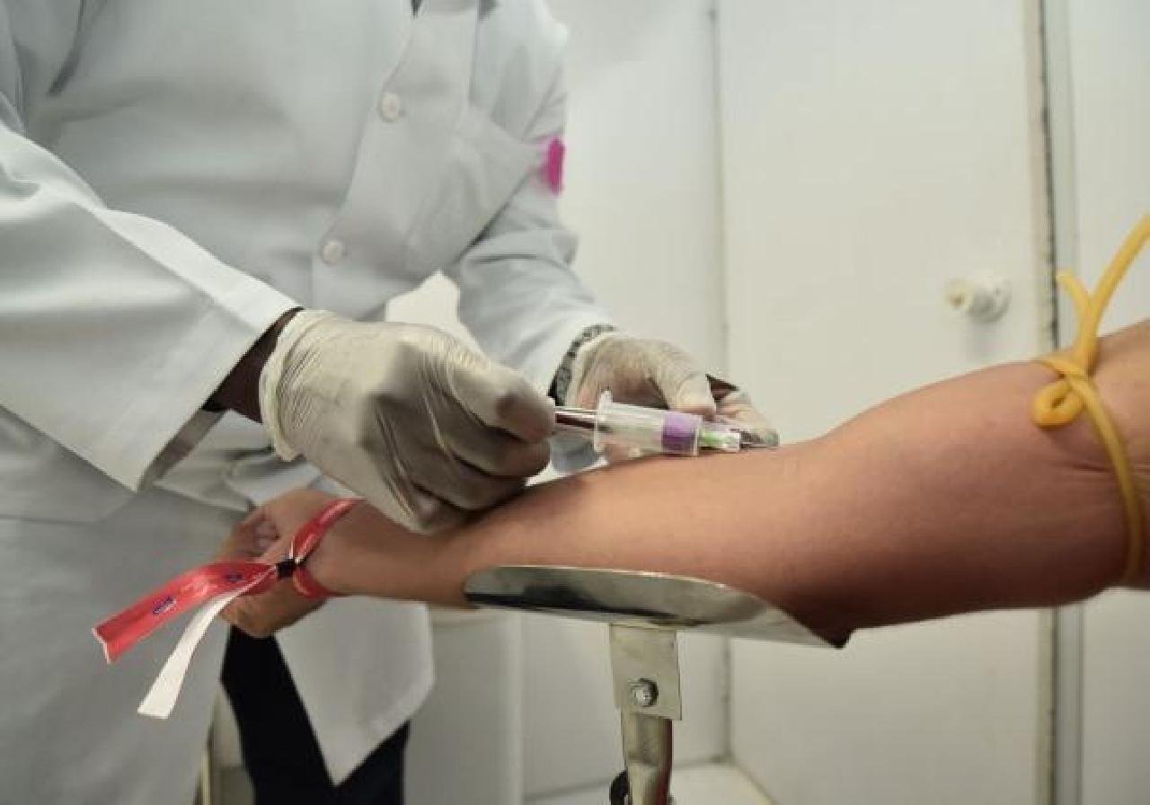 BAHIA TEVE QUASE 800 CASOS DE HIV NO ANO PASSADO BAHIA TEVE QUASE 800 CASOS DE HIV NO ANO PASSADO