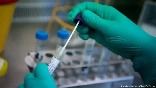  CORONAVÍRUS DEVE INFECTAR 1,1 MILHÃO DE BAIANOS ATÉ MAIO, MOSTRA PESQUISA