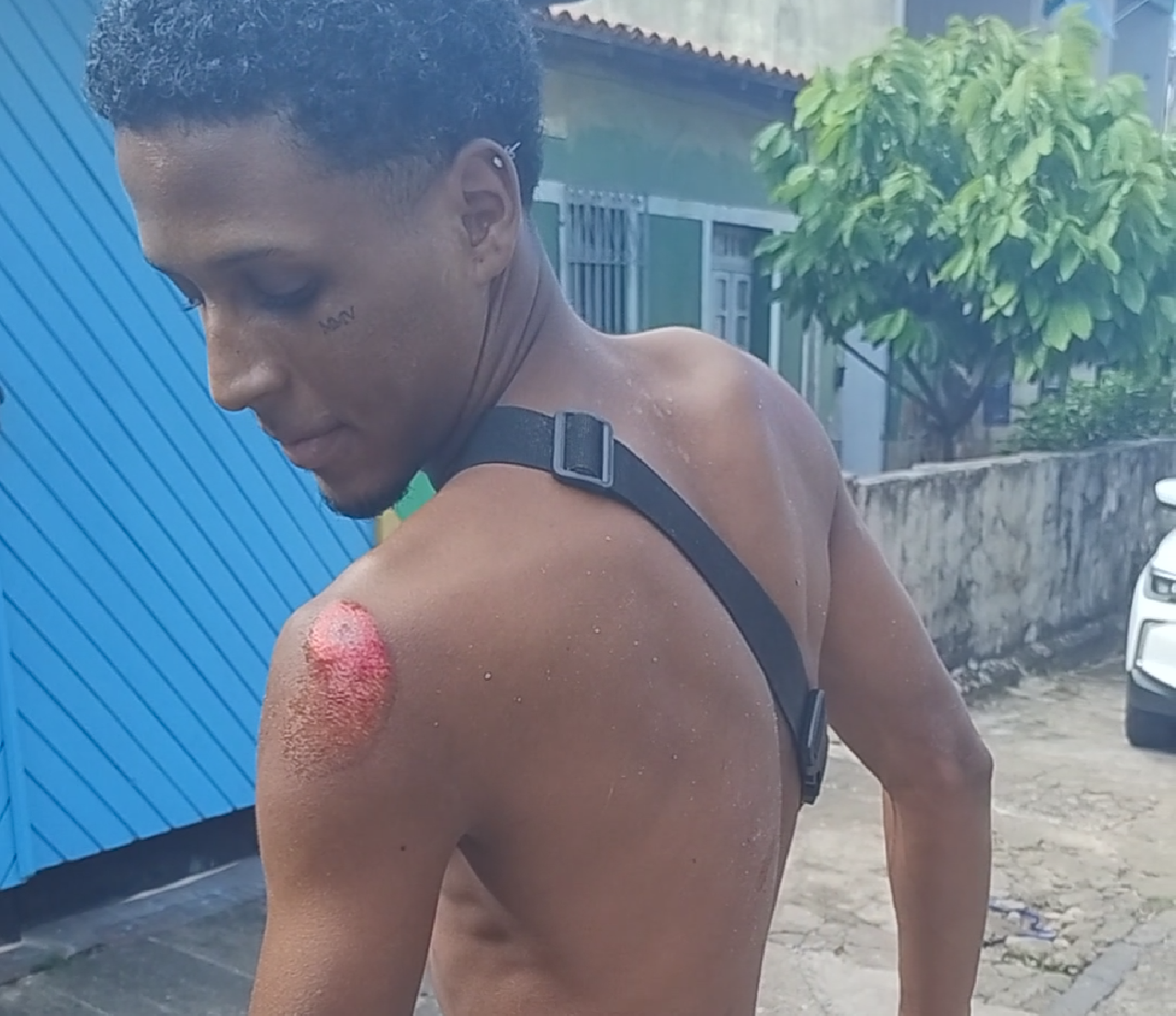 FALTA DE SINALIZAÇÃO EM QUEBRA-MOLAS PROVOCA ACIDENTE NA AVENIDA BELMONTE, EM ILHÉUS FALTA DE SINALIZAÇÃO EM QUEBRA-MOLAS PROVOCA ACIDENTE NA AVENIDA BELMONTE, EM ILHÉUS