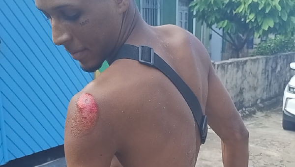 FALTA DE SINALIZAÇÃO EM QUEBRA-MOLAS PROVOCA ACIDENTE NA AVENIDA BELMONTE, EM ILHÉUS