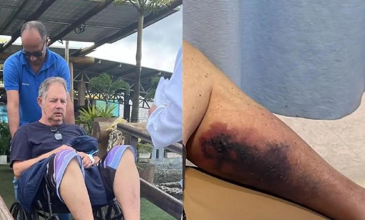 TURISTA MORRE APÓS PICADA DE ARANHA EM MORRO DE SÃO PAULO TURISTA MORRE APÓS PICADA DE ARANHA EM MORRO DE SÃO PAULO