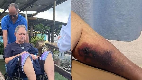 TURISTA MORRE APÓS PICADA DE ARANHA EM MORRO DE SÃO PAULO