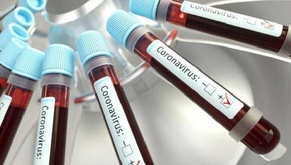 ILHÉUS REGISTRA 07 MORTES POR COVID-19 NAS ÚLTIMAS 24 HORAS
