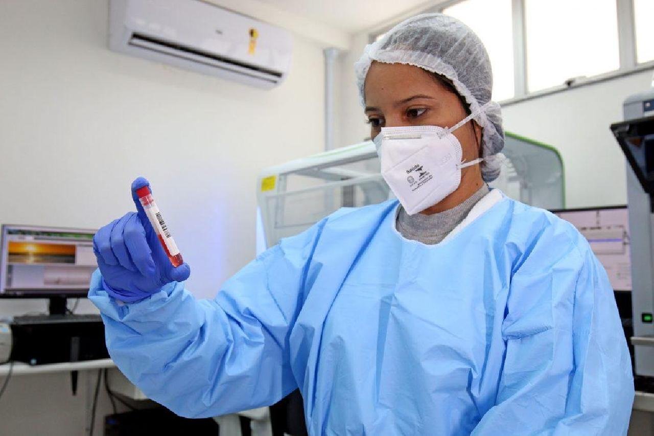 URGENTE: LACEN DETECTA NOVA VARIANTE DO CORONAVÍRUS EM SALVADOR E MAIS 16 CIDADES DA BAHIA URGENTE: LACEN DETECTA NOVA VARIANTE DO CORONAVÍRUS EM SALVADOR E MAIS 16 CIDADES DA BAHIA
