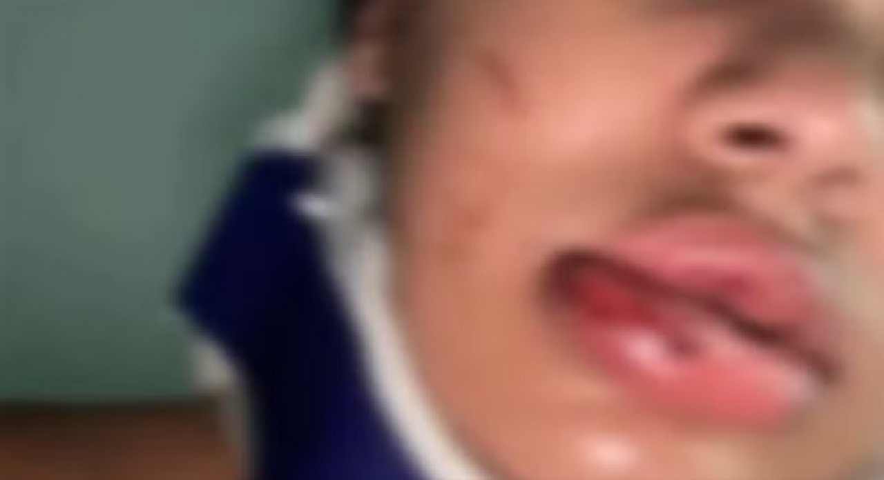 POLÍCIA CONTINUA À PROCURA DE HOMEM QUE AGREDIU MULHER NA ZONA SUL DE ILHÉUS POLÍCIA CONTINUA À PROCURA DE HOMEM QUE AGREDIU MULHER NA ZONA SUL DE ILHÉUS