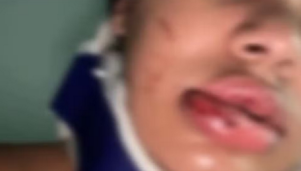 POLÍCIA CONTINUA À PROCURA DE HOMEM QUE AGREDIU MULHER NA ZONA SUL DE ILHÉUS