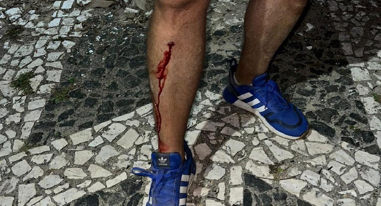 HOMEM SE ACIDENTA EM BURACO NA CALÇADA DA AV. 2 DE JULHO NO CENTRO DE ILHÉUS HOMEM SE ACIDENTA EM BURACO NA CALÇADA DA AV. 2 DE JULHO NO CENTRO DE ILHÉUS