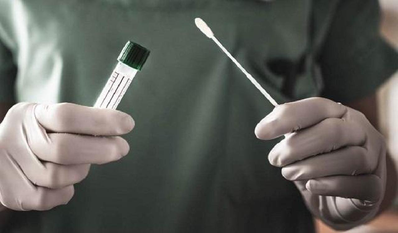 TESTES COVID-19 NÃO SÃO EXCLUSIVOS DA VIGILÂNCIA  EPIDEMIOLÓGICA DE ILHÉUS, ESCLARECE SESAU TESTES COVID-19 NÃO SÃO EXCLUSIVOS DA VIGILÂNCIA  EPIDEMIOLÓGICA DE ILHÉUS, ESCLARECE SESAU