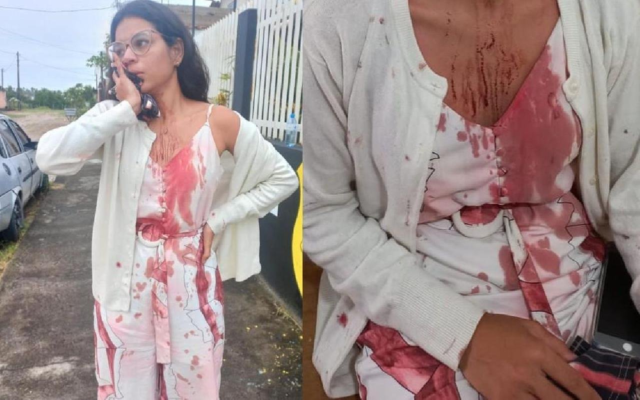 JOVEM MORADORA DE ITABUNA TEM ROSTO CORTADO ENQUANTO DORMIA DURANTE VIAGEM EM ÔNIBUS NA BAHIA 