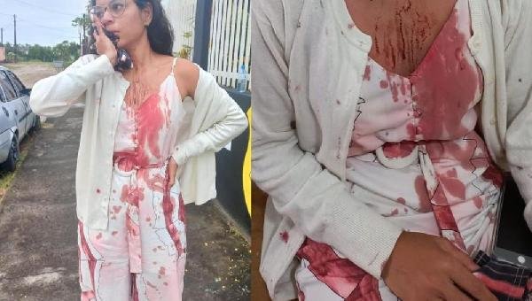JOVEM MORADORA DE ITABUNA TEM ROSTO CORTADO ENQUANTO DORMIA DURANTE VIAGEM EM ÔNIBUS NA BAHIA 