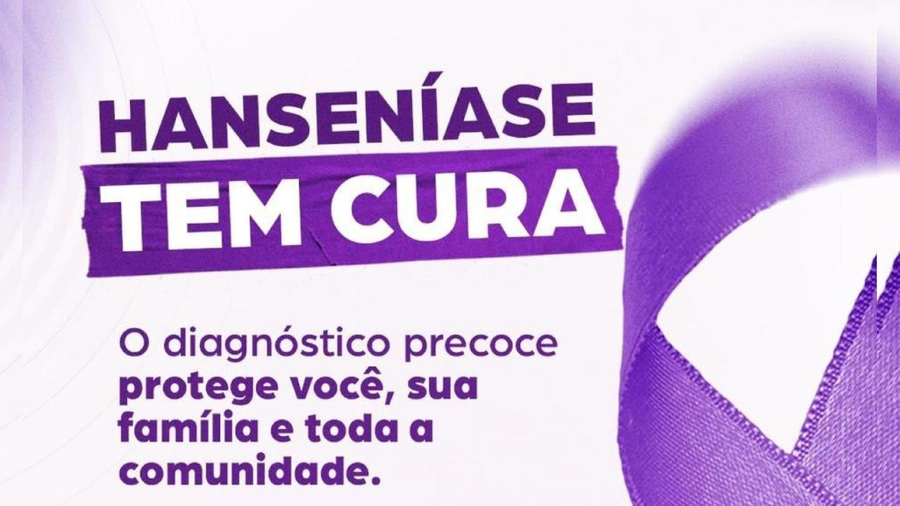 JANEIRO ROXO: ILHÉUS INTENSIFICA AÇÕES DE COMBATE À HANSENÍASE E ENFRENTAMENTO AO PRECONCEITO