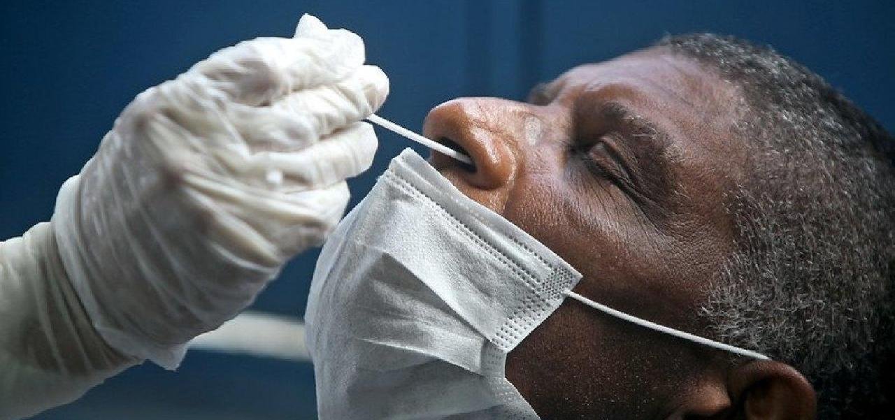 COVID-19: MAIS DA METADE DOS CASOS SÃO ENTRE PESSOAS DE ATÉ 39 ANOS NA BAHIA