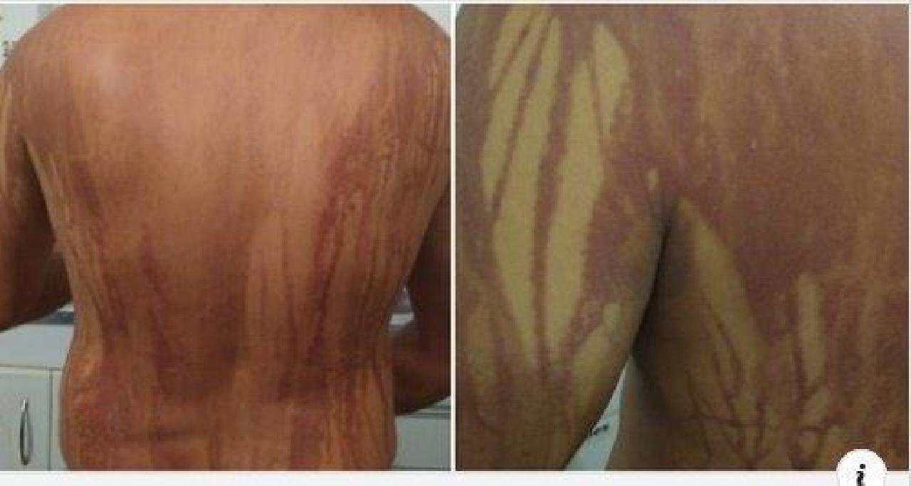 ILHÉUS: “PROVAVELMENTE FOI ÁGUA VIVA”, AFIRMA SECRETÁRIO SOBRE QUEIMADURAS EM TURISTA ILHÉUS: “PROVAVELMENTE FOI ÁGUA VIVA”, AFIRMA SECRETÁRIO SOBRE QUEIMADURAS EM TURISTA