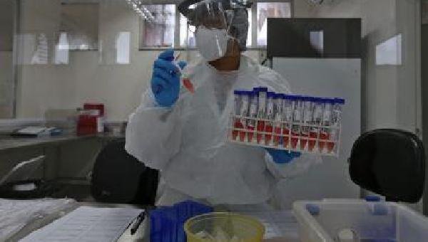  BAHIA VOLTA A REGISTRAR MAIS DE 60 ÓBITOS POR COVID-19.