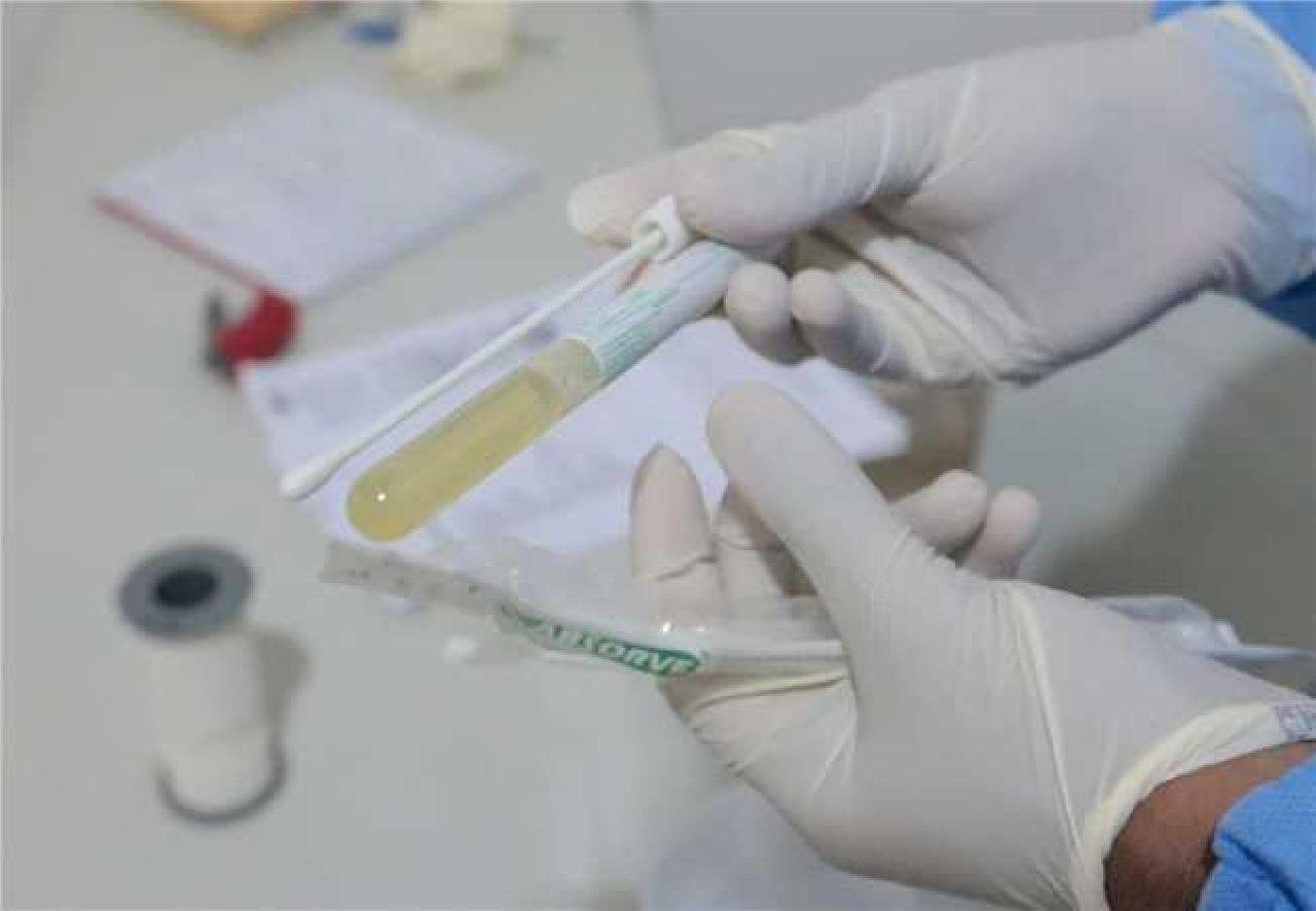 ILHÉUS ESTABELECE NOVO PROTOCOLO PARA DETECÇÃO DA COVID-19 ILHÉUS ESTABELECE NOVO PROTOCOLO PARA DETECÇÃO DA COVID-19