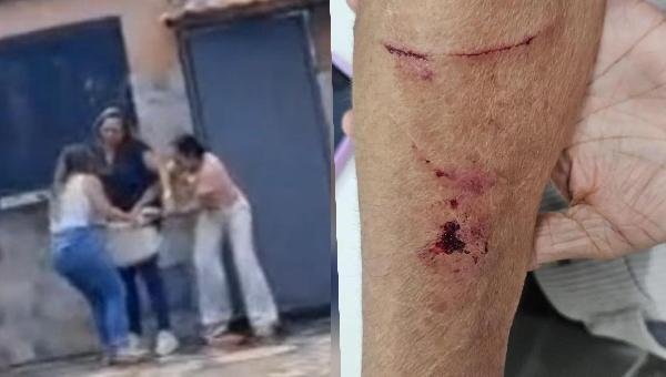 ESTAGIÁRIA QUE SE ENVOLVEU EM AGRESSÃO A IDOSA EM UNIDADE DE SAÚDE É AFASTADA DA PREFEITURA DE ILHÉUS