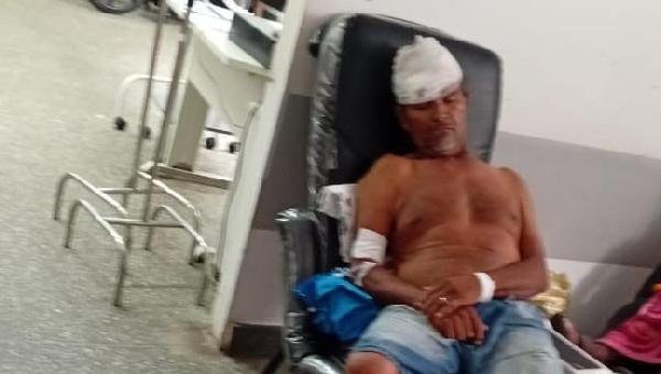 PEDREIRO MORRE APÓS SER AGREDIDO POR CINCO HOMENS NO DIA DA ELEIÇÃO; ELE USAVA CAMISA VERDE COM ADESIVO DO NÚMERO 13