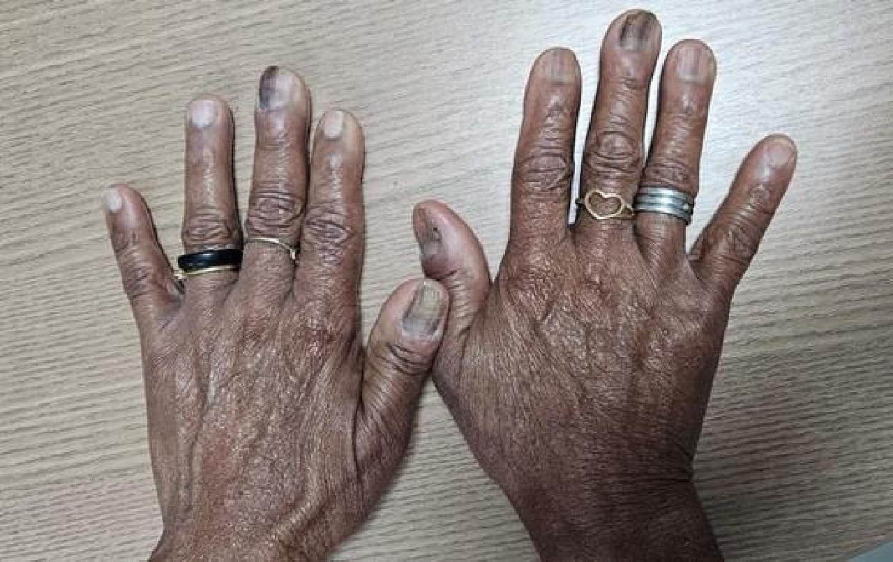 DOMÉSTICA É RESGATADA EM SITUAÇÃO ANÁLOGA À ESCRAVIDÃO EM ITABUNA