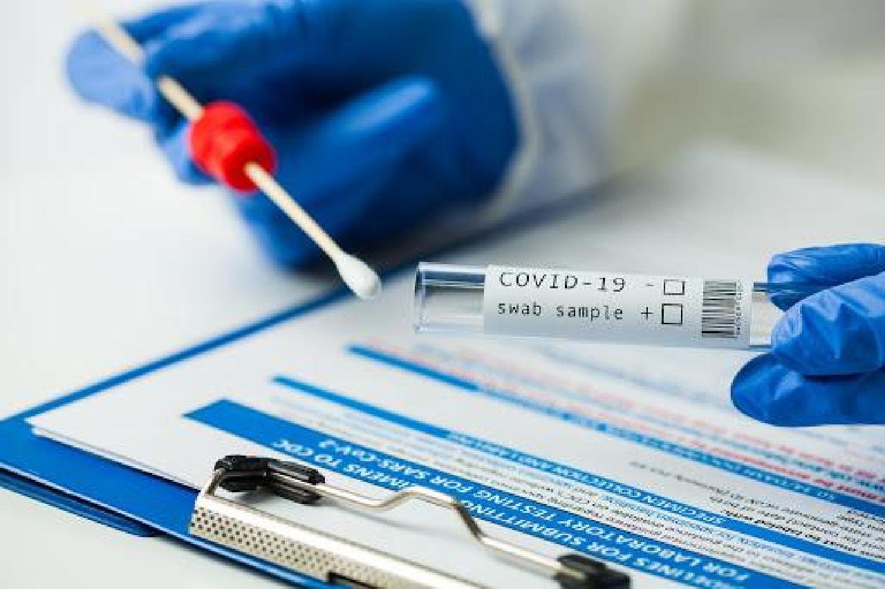 COVID-19: ILHÉUS REGISTRA 10 MORTES EM 48 HORAS COVID-19: ILHÉUS REGISTRA 10 MORTES EM 48 HORAS