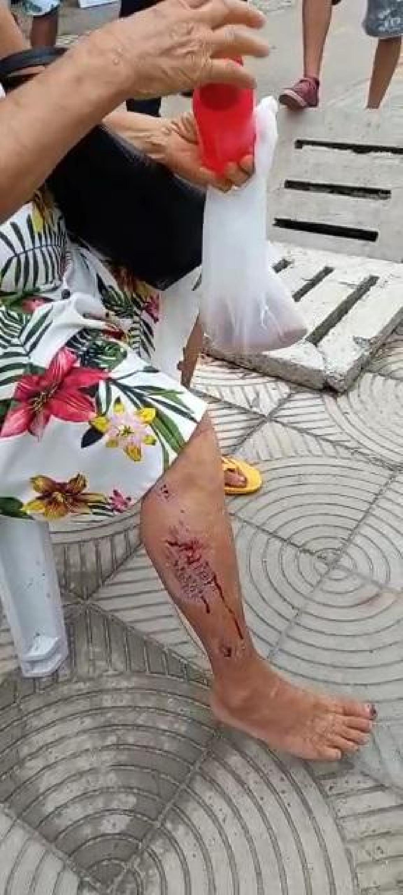 IDOSA CAI EM OBRA INACABADA NO CALÇADÃO PARANAGUÁ IDOSA CAI EM OBRA INACABADA NO CALÇADÃO PARANAGUÁ