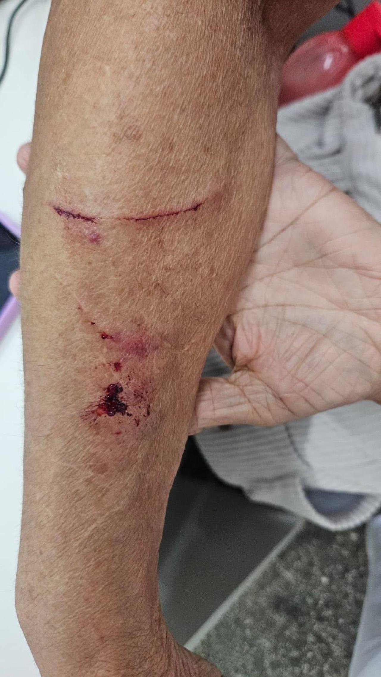 IDOSA DE 72 ANOS DENUNCIA AGRESSÃO EM POSTO DE SAÚDE APÓS REIVINDICAR DIREITOS