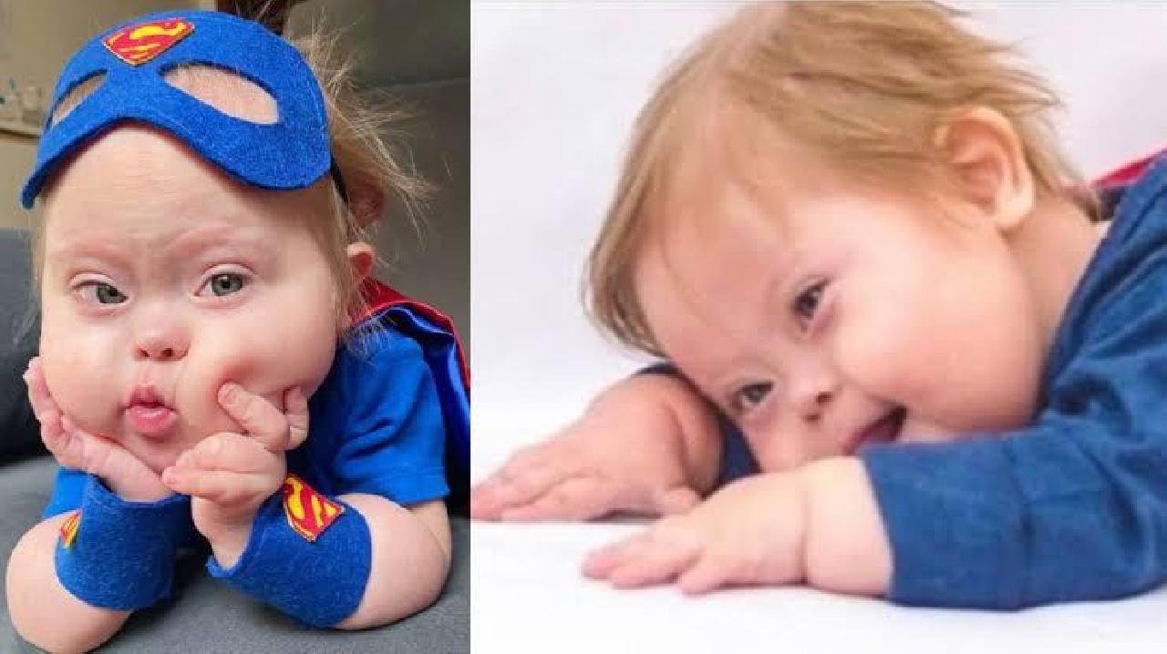 MORRE ‘SUPER CHICO’, MENINO COM DOWN QUE VIRALIZOU NA WEB APÓS VENCER A COVID-19 POR DUAS VEZES MORRE ‘SUPER CHICO’, MENINO COM DOWN QUE VIRALIZOU NA WEB APÓS VENCER A COVID-19 POR DUAS VEZES